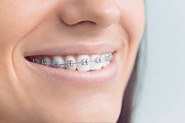 Best Invisalign and Clear Aligners  in West Liberty, IA